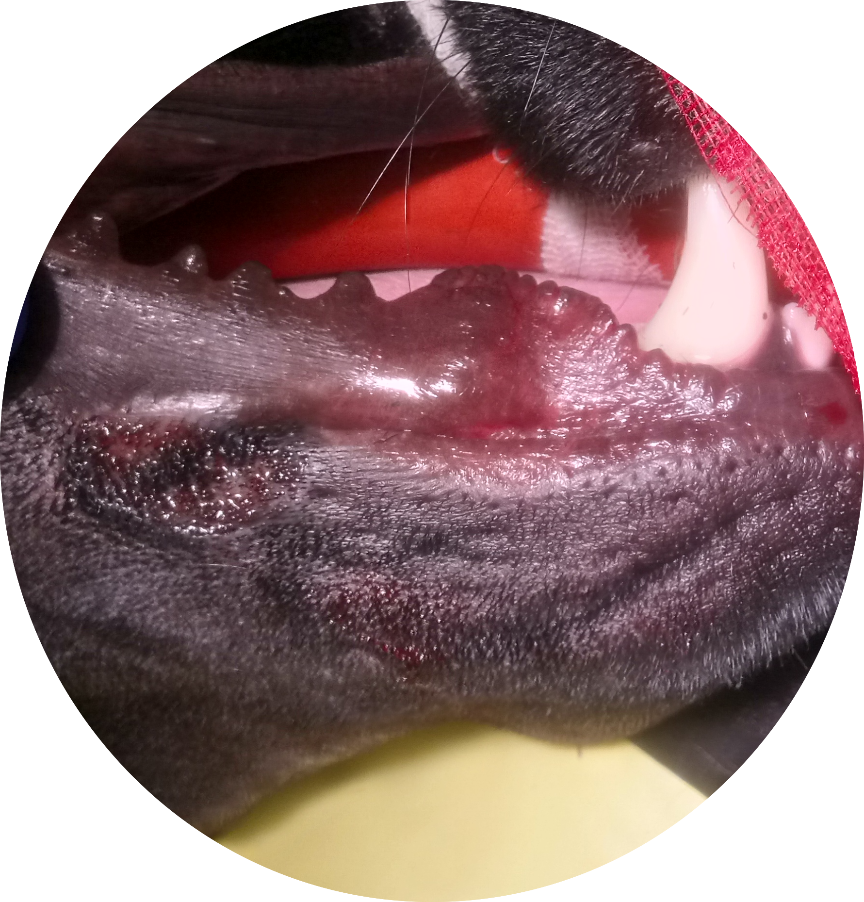 The infection underneath my lip fold.