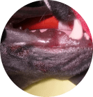 The infection underneath my lip fold.