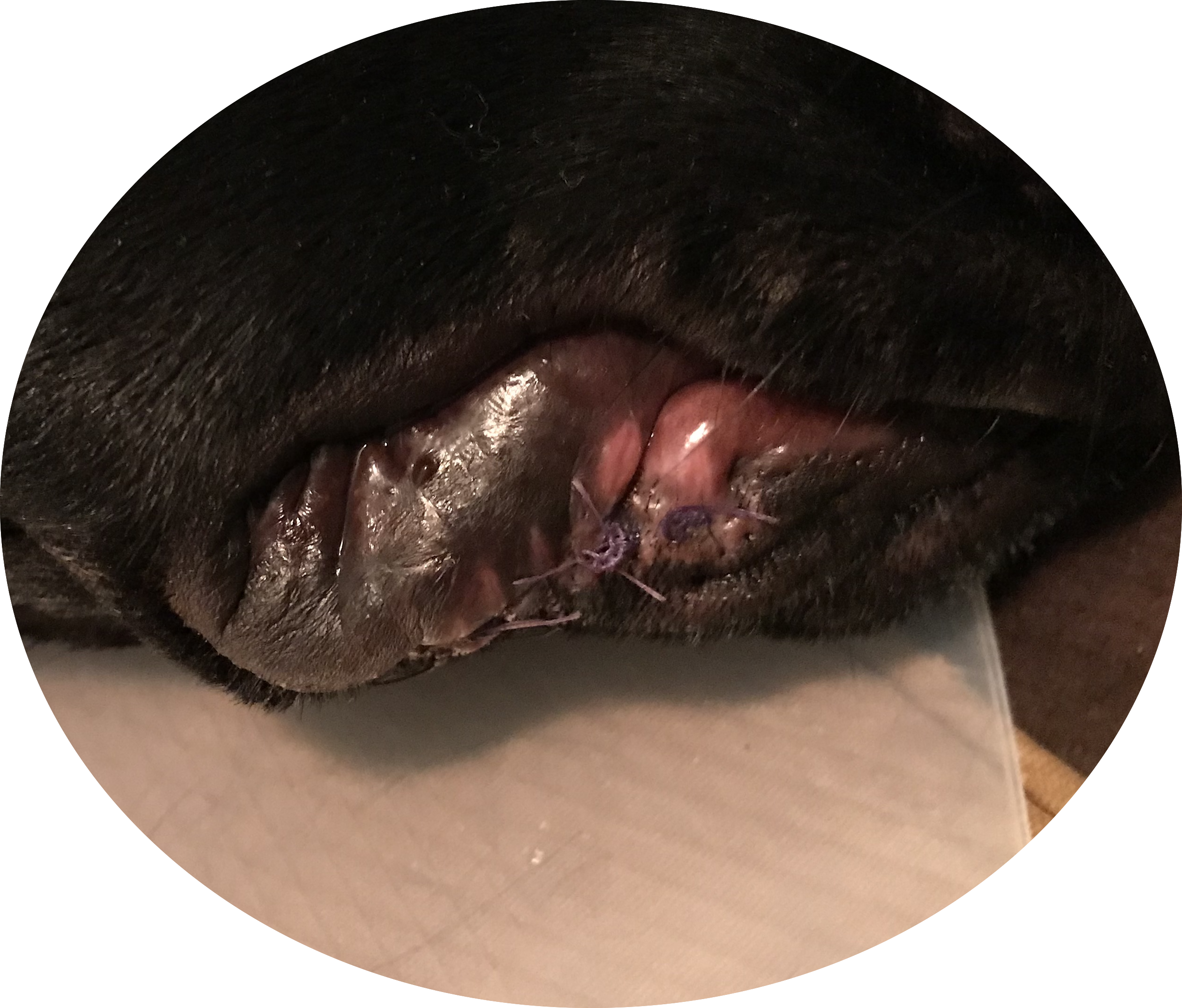 Post lip dermatitis operation.